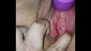 Milf cervix